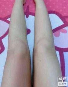 怎么减肥大腿视频