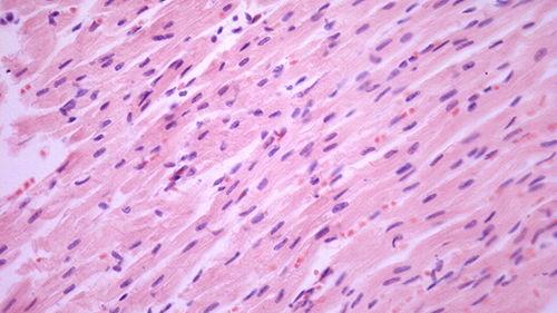 皮下囊视频,视频带你探索人体奥秘